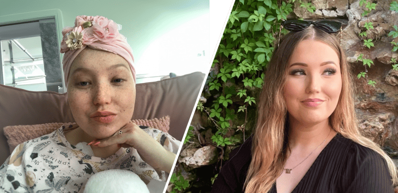 Stem Cell recipient, Sophie, before and after transaplant
