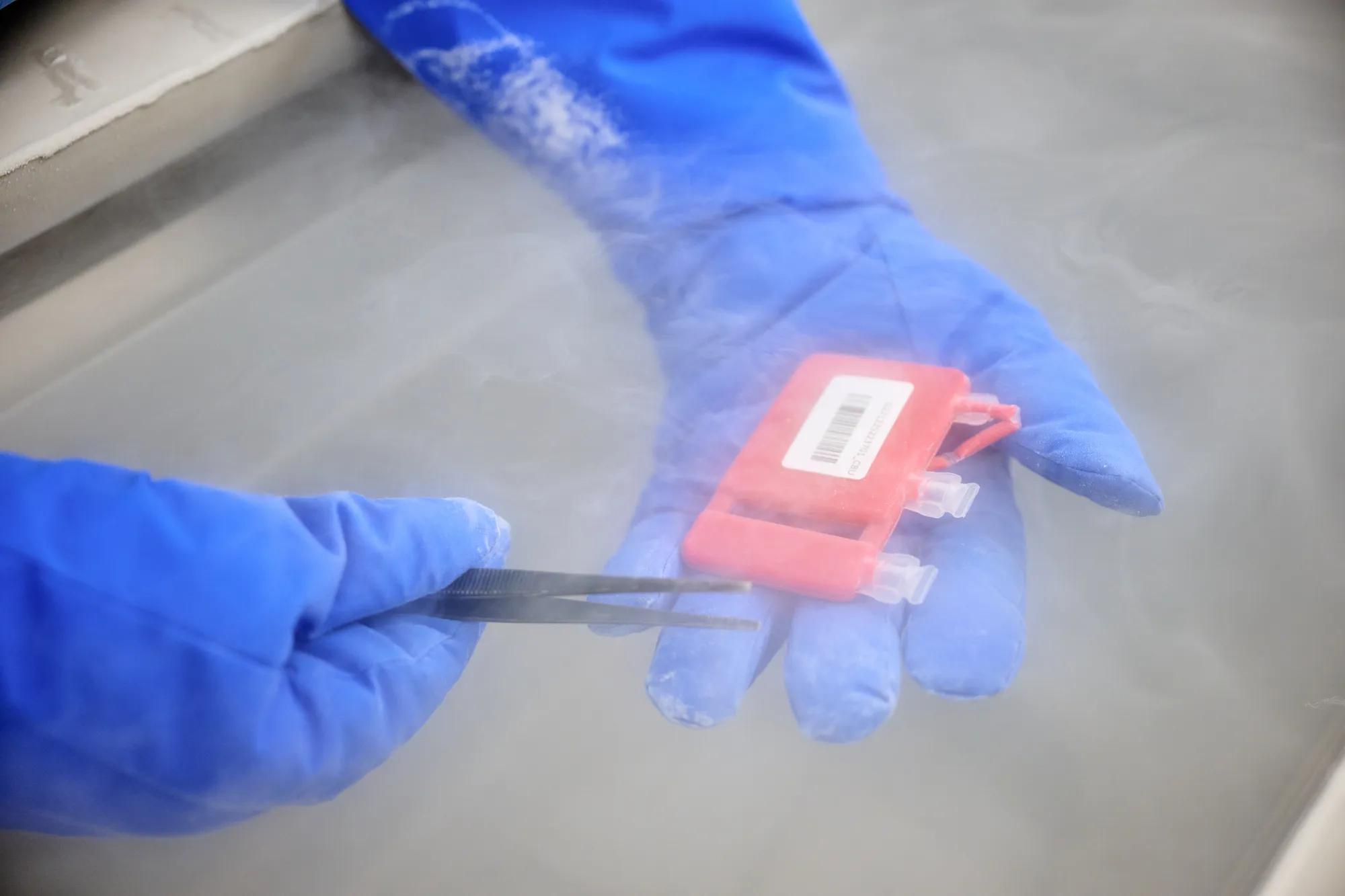 Researcher examining a cryogenic sample in a cryotank