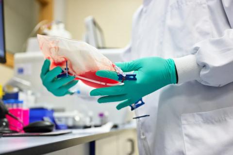Gloved hands hold donated stem cell bag.
