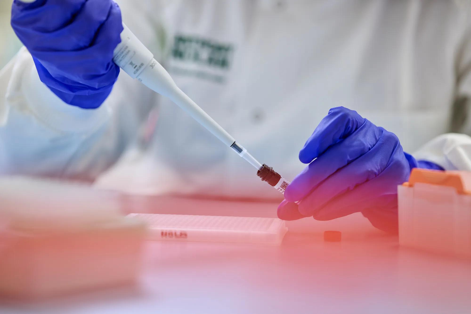 Researcher using micropipette