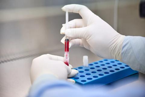 Gloved hands using a syringe to extracting cord blood sample.