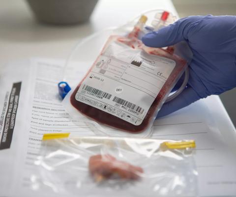 Cord blood collection process