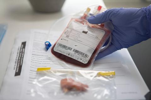 Cord blood collection process