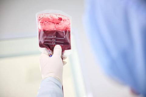 Blood sample bag being held by gloved hands.