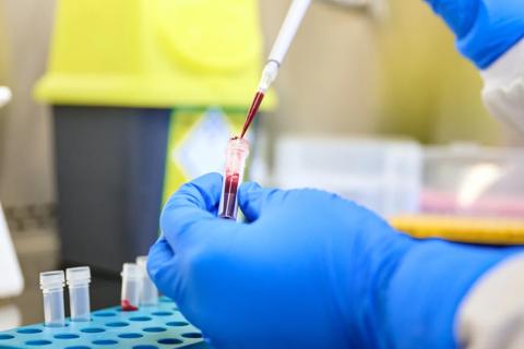Researcher pipetting blood samples 