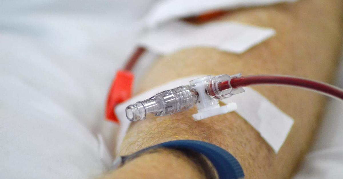 美容液 D.P.L Cell Infusion Program Donor lymphocyte infusion (DLI) | Anthony Nolan