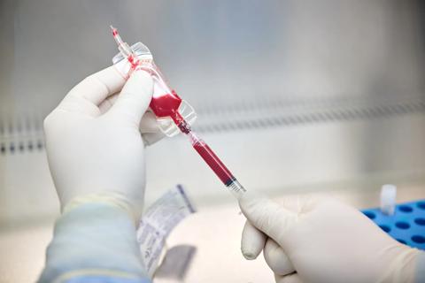 Gloved hands using a syringe to extracting cord blood sample.