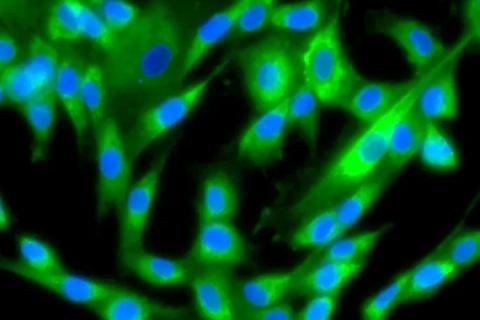 Close up of green and blue cells