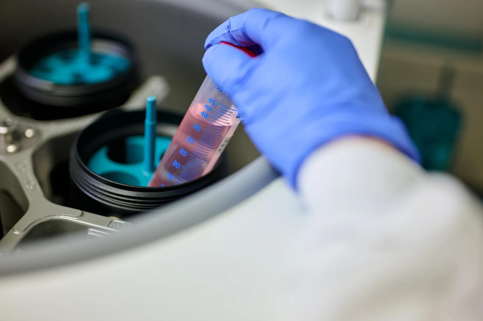 A stem cell sample being placed in a clinical centrifuge