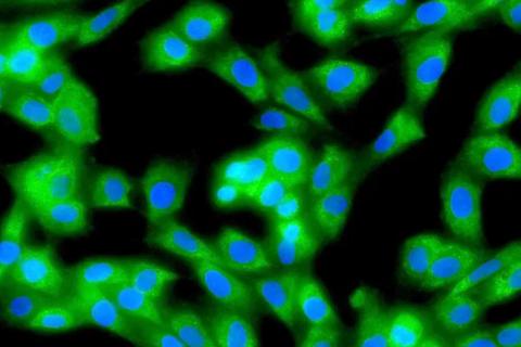 Close up of green and blue cells