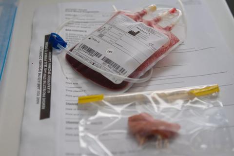Cord blood collection process