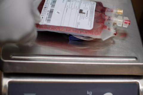 Cord blood collection process