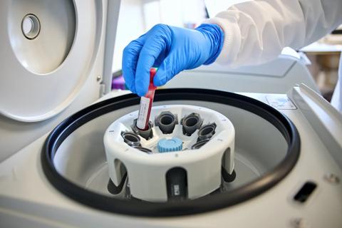 Researcher placing blood sample in a clinical centrifuge
