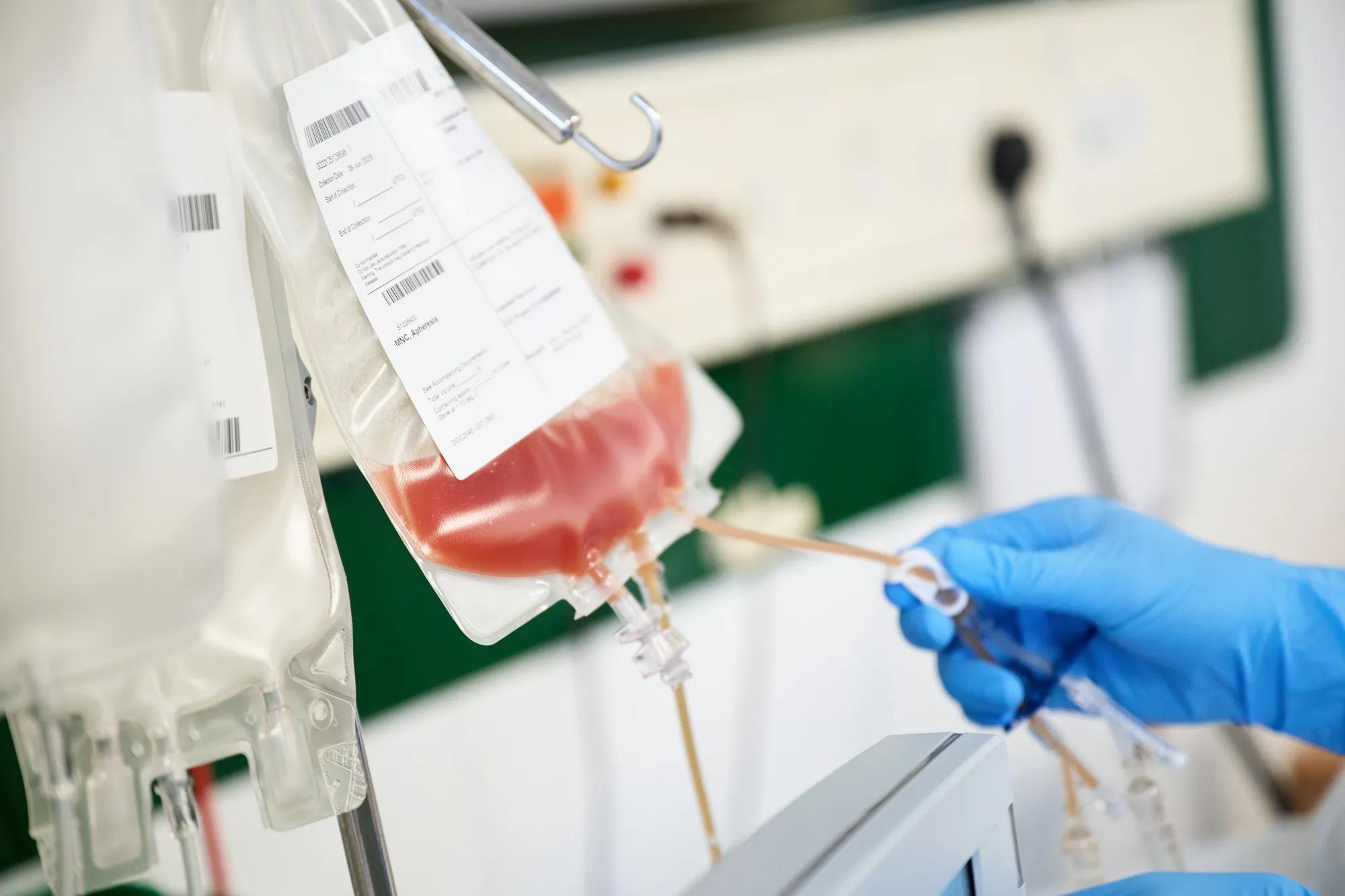 Nurse checks on a bag of stem cells for a patient