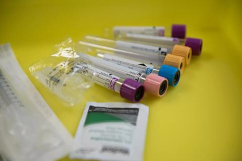 Hospital test tubes, blood works