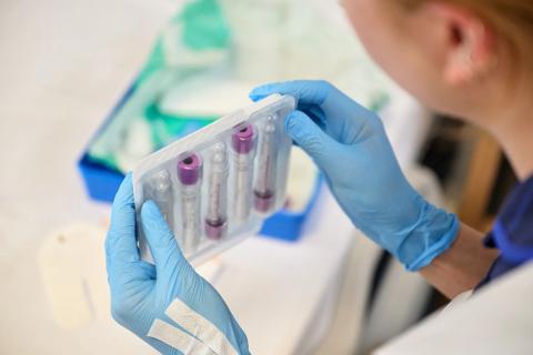 Nurse holds container with test tubes in it with gloved hands.