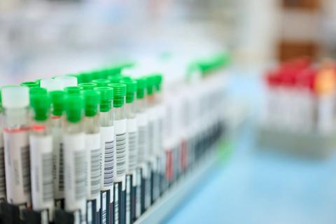 Close up of sample tubes in a tube holder